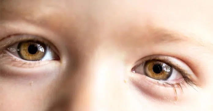 8 علامات صحية تكشف عن حالتك من خلال عينيك: دلالات صحية لا يجب تجاهلها