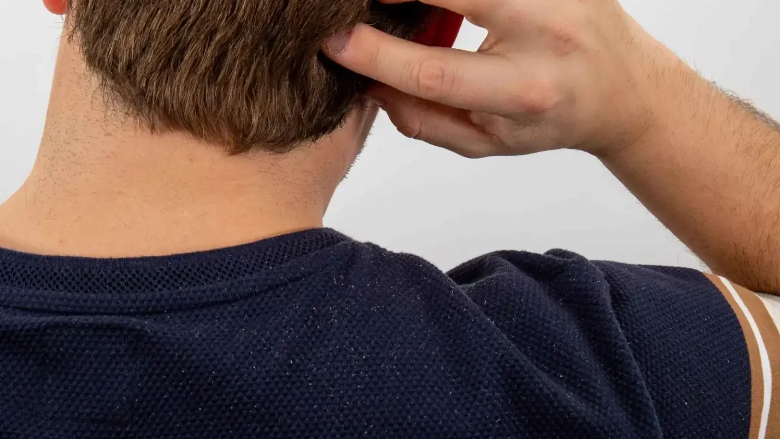 نصائح الأطباء للتخلص من قشرة الرأس