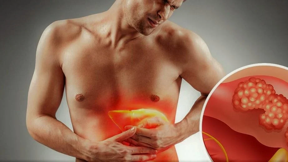 أعراض عدوى فيروس الكبد الوبائي B