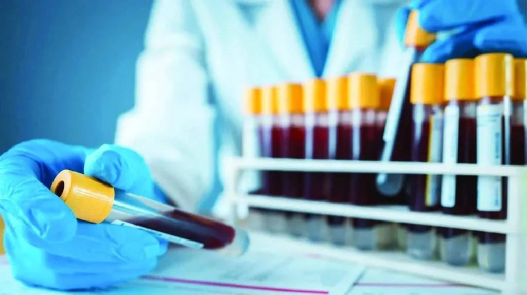 فحص دم يتنبأ بأمراض الكبد قبل ظهورها بعشر سنوات