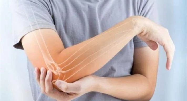 من التعب إلى هشاشة العظام: أعراض نقص الكالسيوم لدى النساء