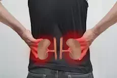 أطعمة قد تضر كليتك دون أن تدري.. احذرها فوراً