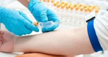 فحص دم بالذكاء الاصطناعي لتحديد علامات الشيخوخة في الجسم