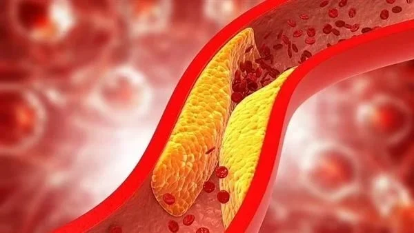 آثار أدوية الكوليسترول الجانبية وكيفية التعامل معها