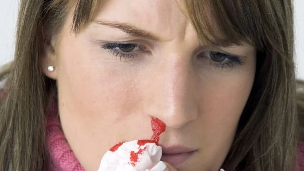 إيقاف نزيف الأنف بسرعة خلال ثوانٍ وبخطوات بسيطة