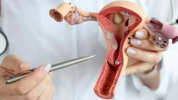 كيف يتراجع تكيس المبايض خلال الدورة وهل له شكل محدد؟