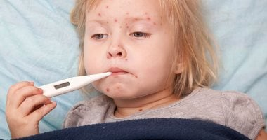 الجدري المائي أبرزها.. أنواع العدوى الجلدية للأطفال وطرق علاجها