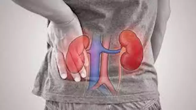 7 علامات تدل على الفشل الكلوي المفاجئ