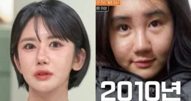 كورية جنوبية تخضع لـ400 عملية تجميل خلال 15 عامًا