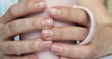 علامات الأظافر تدل على حالات صحية كامنة يجب الانتباه لها