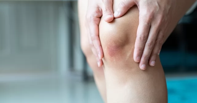 نقص الشمس في الشتاء يهدد العظام.. طرق للحماية