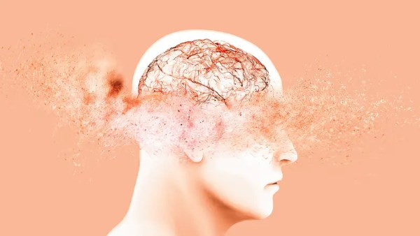 الدراسات الجينية تفتح باب علاج الزهايمر