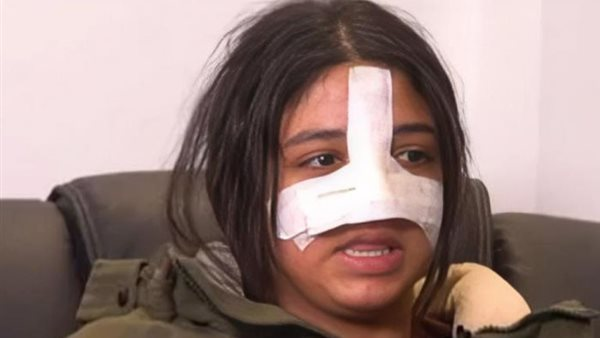 جنايات الطفل: أول تعليق من دفاع الطالبة كرما على ضربها بمدرسة دولية