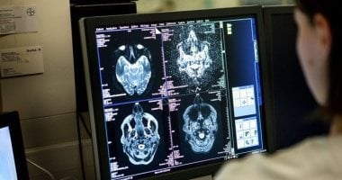 دراسة مراحل نموها: علماء يضعون المسودة الأولى لكتاب خرائط الدماغ