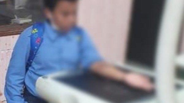 مدرس يضرب طالب ابتدائي بقطعة خشب في مدرسة بالفيوم ويكسر يده