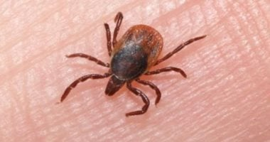 أمريكا تسجل أول وفاة بسبب حساسية اللحوم الناتجة عن لدغة قراد لدى رجل
