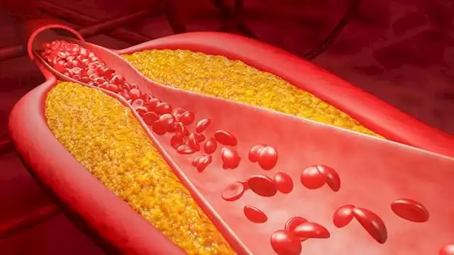 خضار يخفض الكوليسترول والسكر احرص على تناوله