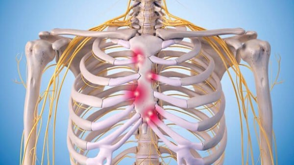 أسباب ألم عظام القفص الصدري عند الضغط عليها