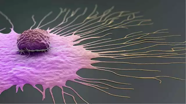 دراسة: الأطعمة فائقة المعالجة تزيد مخاطر سرطان الأمعاء