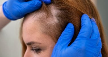 وصفات طبيعية لنمو شعر الرضيع بخطوات سهلة وآمنة