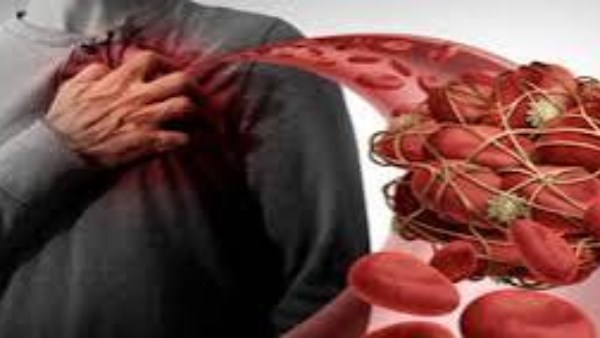 أعراض مؤلمة لارتفاع الكوليسترول: ما هي وطرق التخلص منها