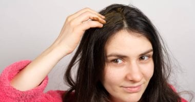 وصفات طبيعية لعلاج قشرة الرأس الدهنية: القهوة في الصدارة