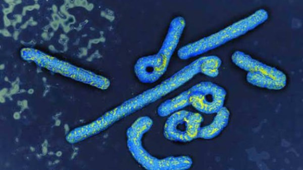 7 معلومات عن فيروس ماربورج: ما قد لا تعرفه عنه