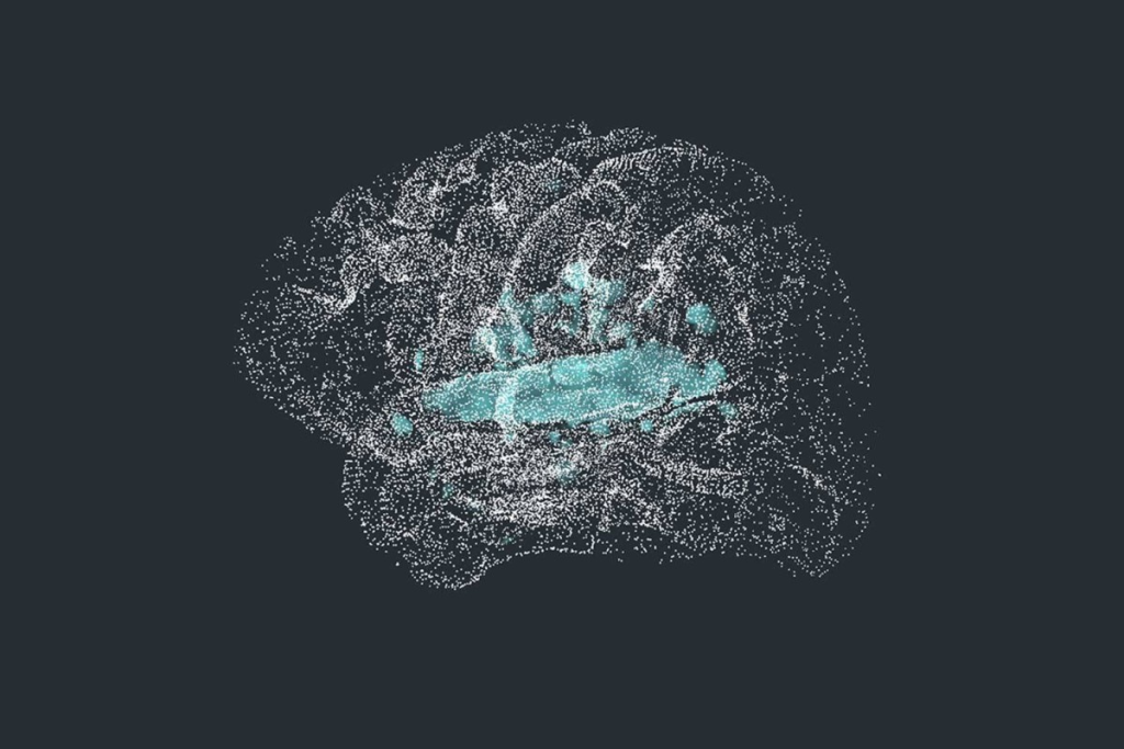 خلايا دماغية تتيح فهم الكلام السريع