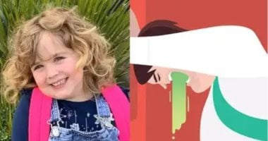 وفاة طفلة بريطانية بسبب مضاعفات نادرة لإزالة اللوزتين: ما هو القيء الدوري؟