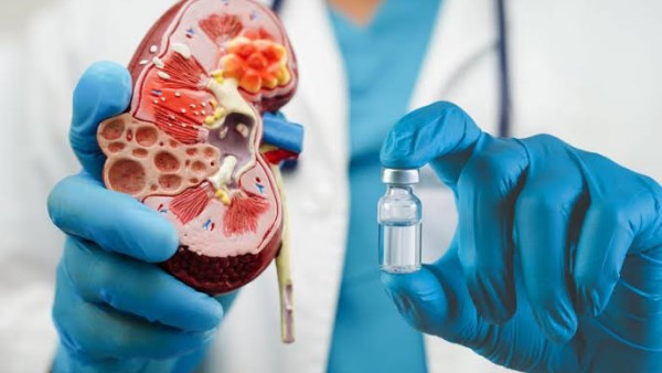 قلة شرب الماء من أبرز أسباب الفشل الكلوي