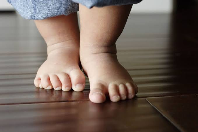 أعراض الكساح وعلاقته بفيتامين شهير