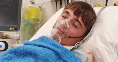 بقع سوداء في رئة مراهق نيوزيلندي بسبب إدمان الفيب