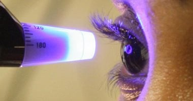 الجلوكوما: من أبرز أسباب صداع الجانب الأيسر وطرق علاجه