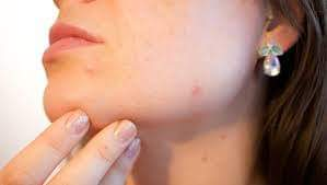 ماسك صباحي لترطيب البشرة في الشتاء