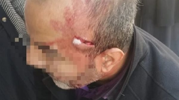 عاجل.. تعليم يصدر تعليقًا حول الاعتداء على معلم بالإسماعيلية