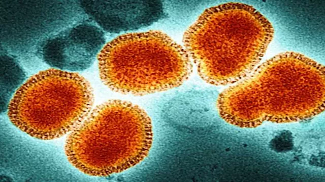 مرض جديد يثير القلق ينتقل من الحيوانات إلى الإنسان