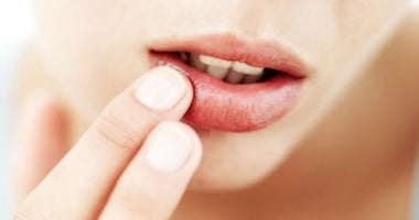 طرق علاج تشقق الشفاه في 3 أيام فقط لتصبح ناعمة ورطبة
