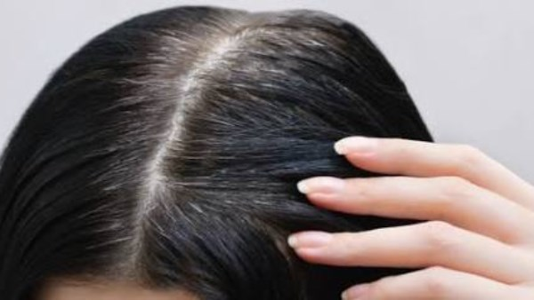 أسباب الشيب المبكر وطرق العلاج والوقاية