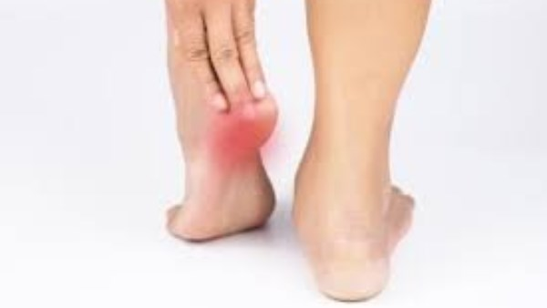 الشوكة العظمية: الأسباب الخفية وراء التهاب اللفافة الحمضية