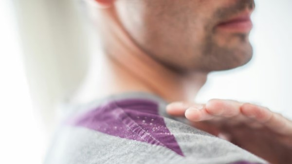 فطريات فروة الرأس: الأسباب والأعراض وطرق العلاج الفعالة