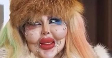 إنفلونسر تثير الجدل بعد 388 عملية تجميل وتصرح: الجوهر أهم من الشكل