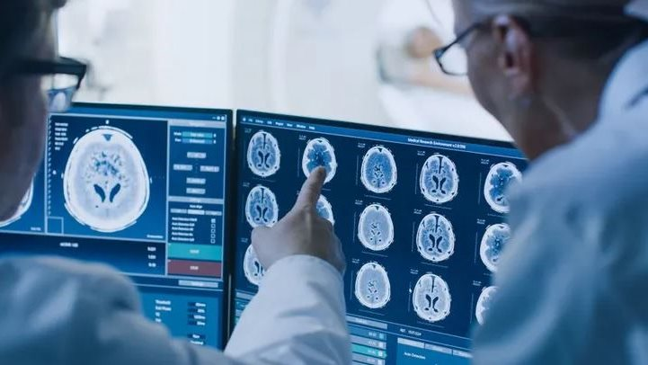 احذر: أعراض غير متوقعة قد تشير إلى وجود أورام الدماغ
