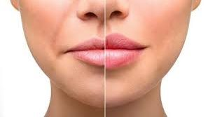 أفضل 5 وصفات منزلية لتقشير الشفاه في كل بيت