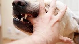 كيف تتصرف أثناء هجوم الكلب؟