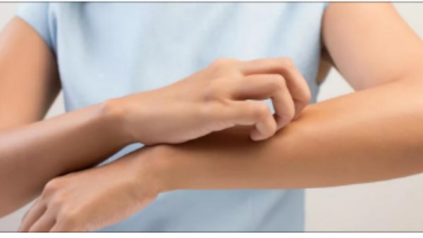 الحكة المستمرة قد تشير إلى 3 أمراض مميتة