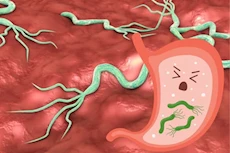 أعراض خفية تدل على جرثومة المعدة