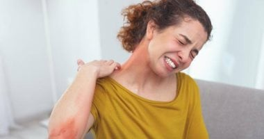 هل التوقف المفاجئ عن الستيرويدات يسبب إكزيما جلدية؟