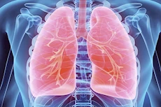 كيف يخفي جسمك الحديد لمكافحة العدوى في الرئتين؟