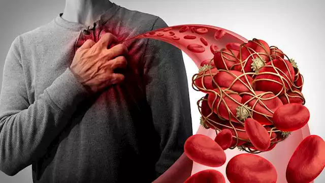 إنذار مبكر: علامة خفية لانسداد شرايين القلب لا تهملها