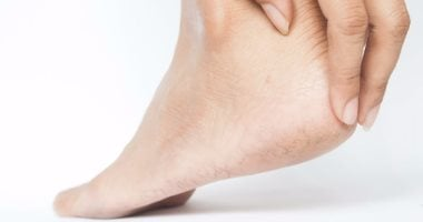 هل تعانى من حكة مستمرة فى ساقيك؟ قد تكون علامة على مشكلة صحية